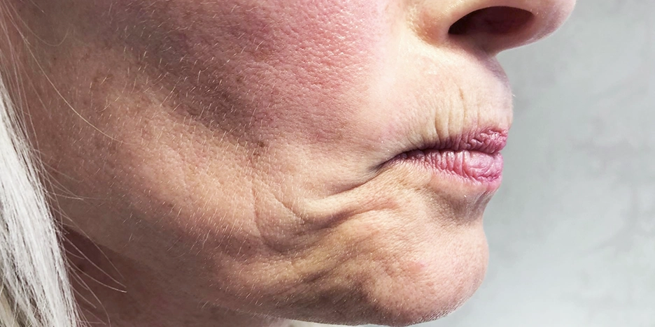 Voor